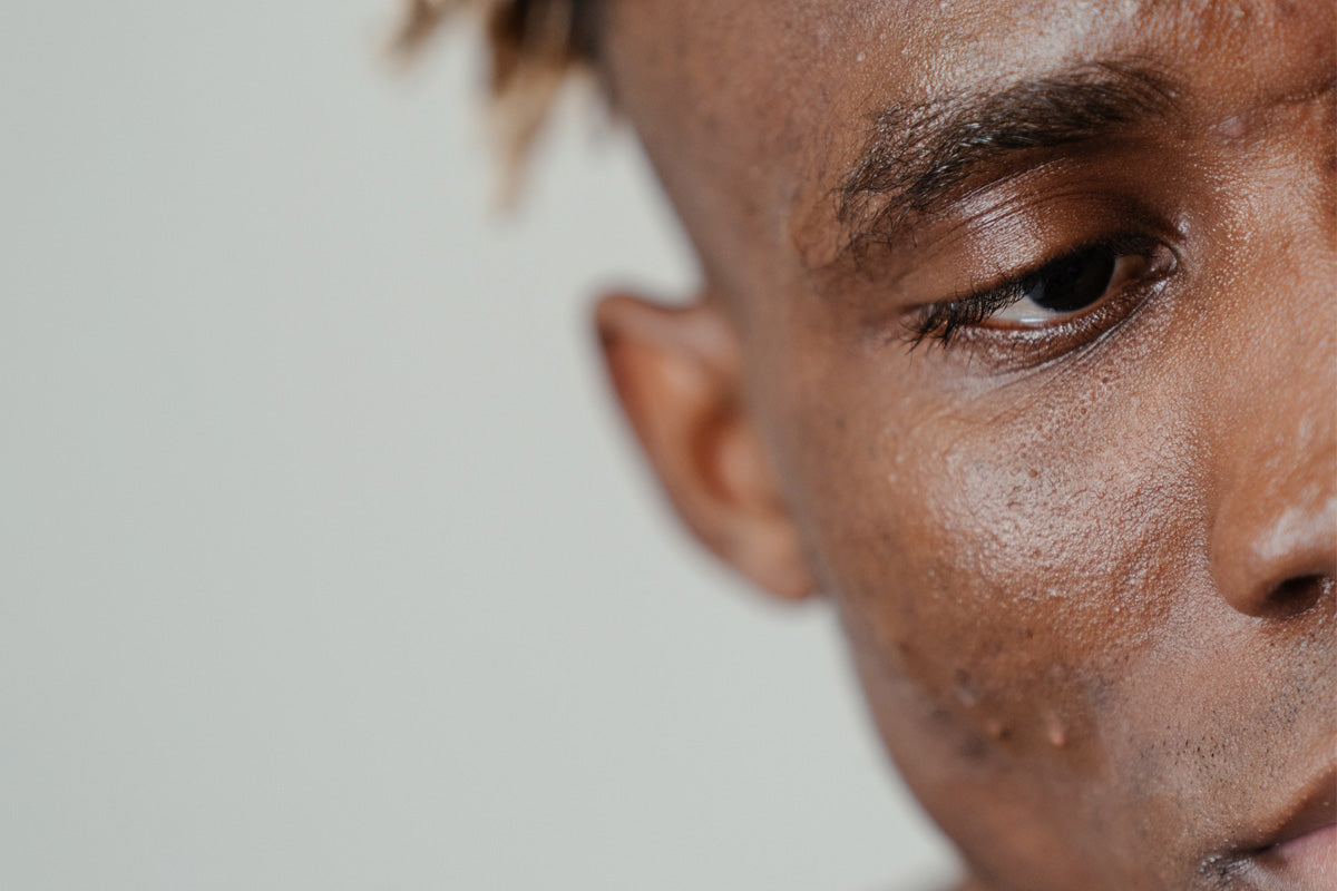 effective treatments for acne scars my organic zone blog