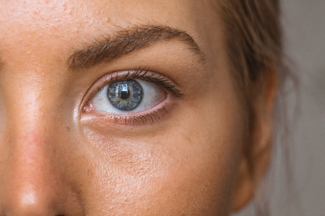 blackheads extraction prevention my organic zone
