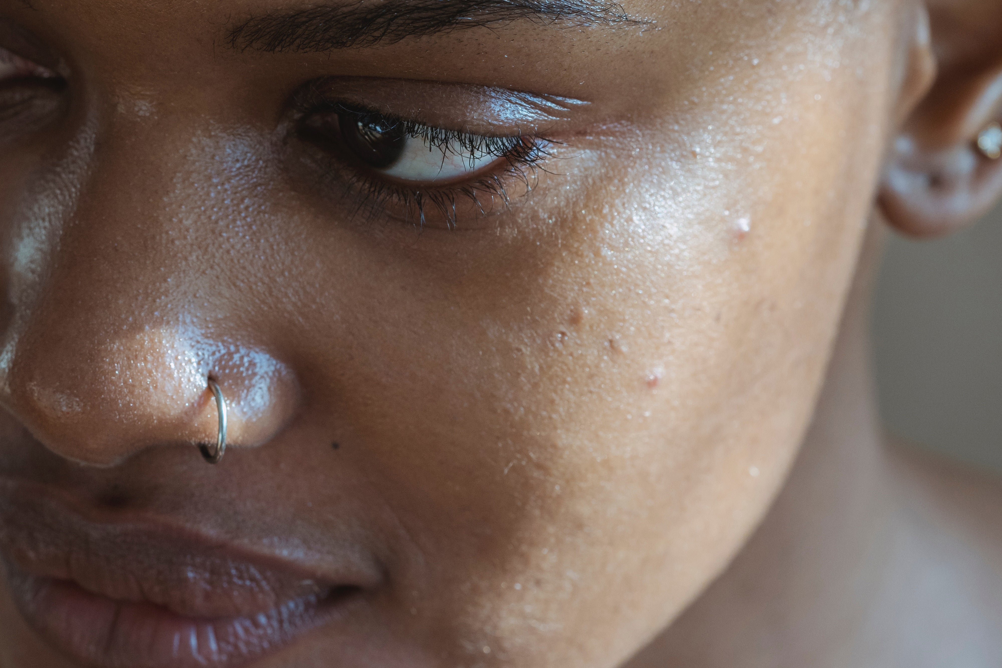 The Best and Worst Ways to Remove Blackheads: A Comprehensive Guide